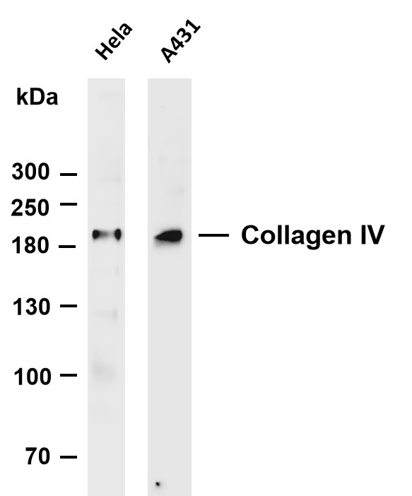 Collagen IV (PT0131R) PT® Rabbit mAb