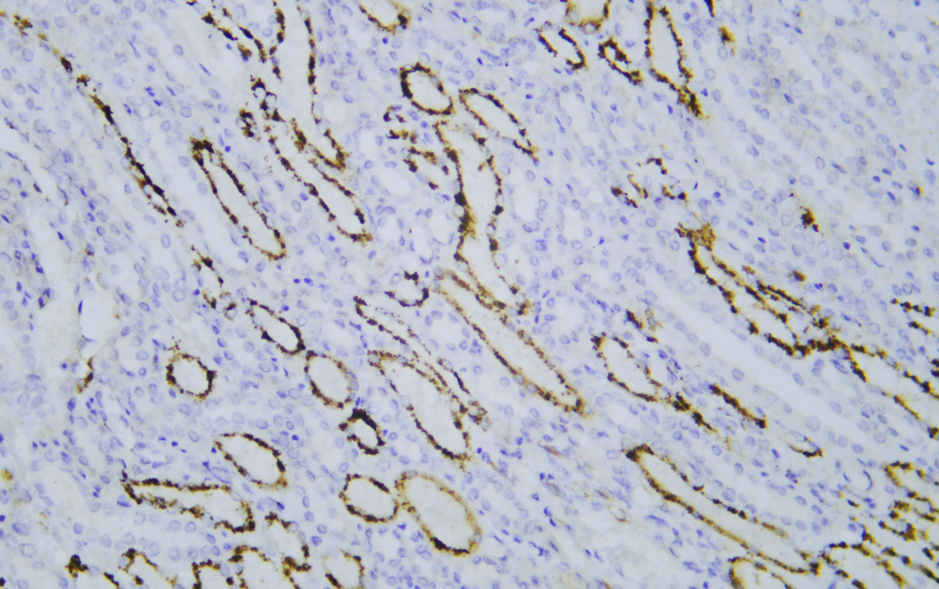 Napsin A (PT2252) mouse mAb