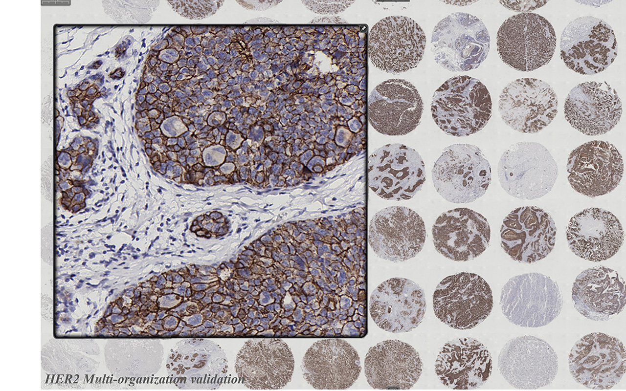 HER2 / Ki-67 / Cytokeratin mouse mAb（病理级抗体）